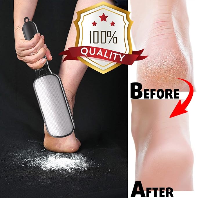 Antonki Foot File for Dead Skin, Double Sided Callus Remover for Feet, Metal - Image 4