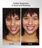 INIA Red Light Therapy Mask for Face, Glow Wireless LED Face Mask Light Therapy - Image 7