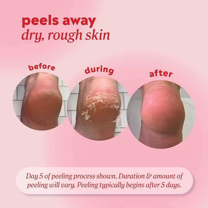 Onyx Professional Foot Peel Mask Callus Remover, 2 pack - Image 4