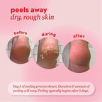 Onyx Professional Foot Peel Mask Callus Remover, 2 pack - Image 4