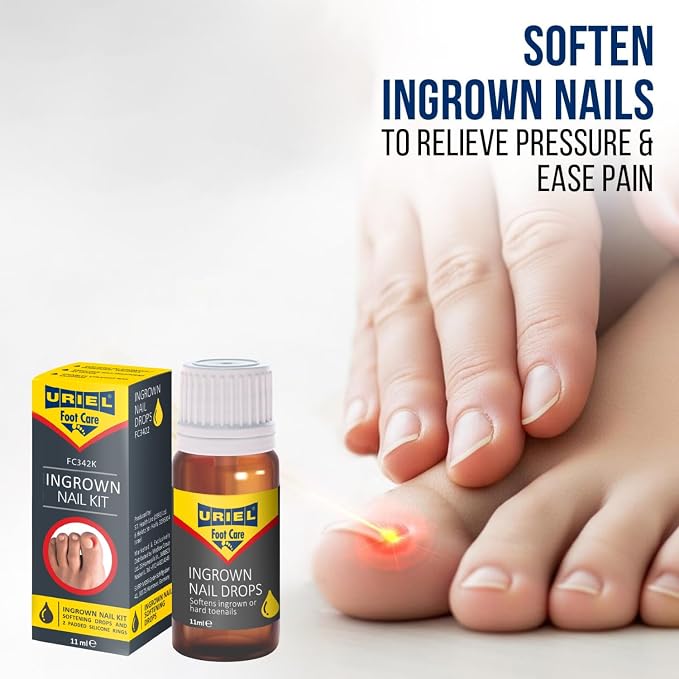 URIEL UPGRADED Ingrown Toenail Treatment - Image 3