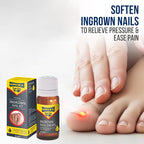 URIEL UPGRADED Ingrown Toenail Treatment - Image 3