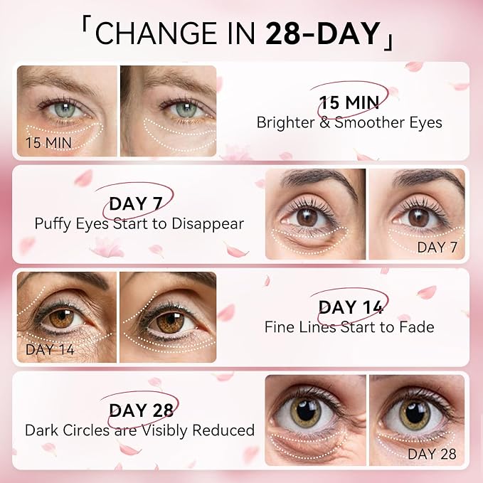 BREYLEE Flamingo Pink Eye Mask–60 Pcs-Puffy Eyes and Dark Circles - Image 6