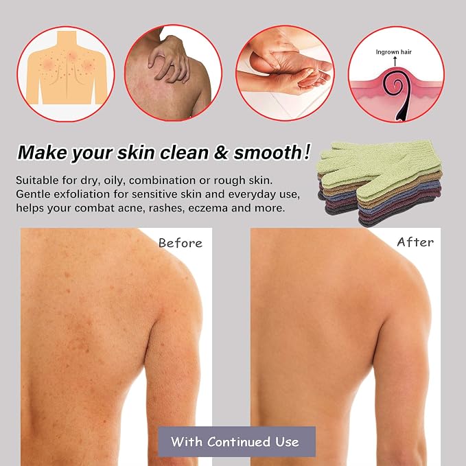 MIG4U Shower Exfoliating Scrub Gloves, Bathing Gloves Body Wash Dead Skin - Image 4