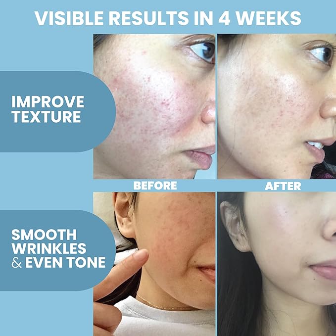 Collagen Serum for Face by Eva Naturals - Image 3
