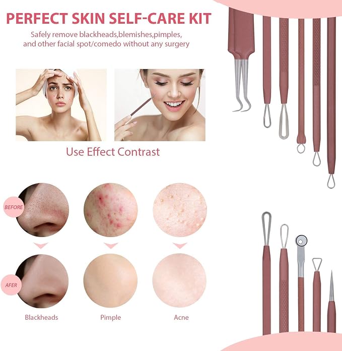 JPNK Blackhead Remover Tool Comedones Extractor Acne Removal Kit - Image 2