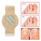 Fungal Nail Patches -Toenail Treatment Extra Strength 21Pcs- Nail Repair - Image 2