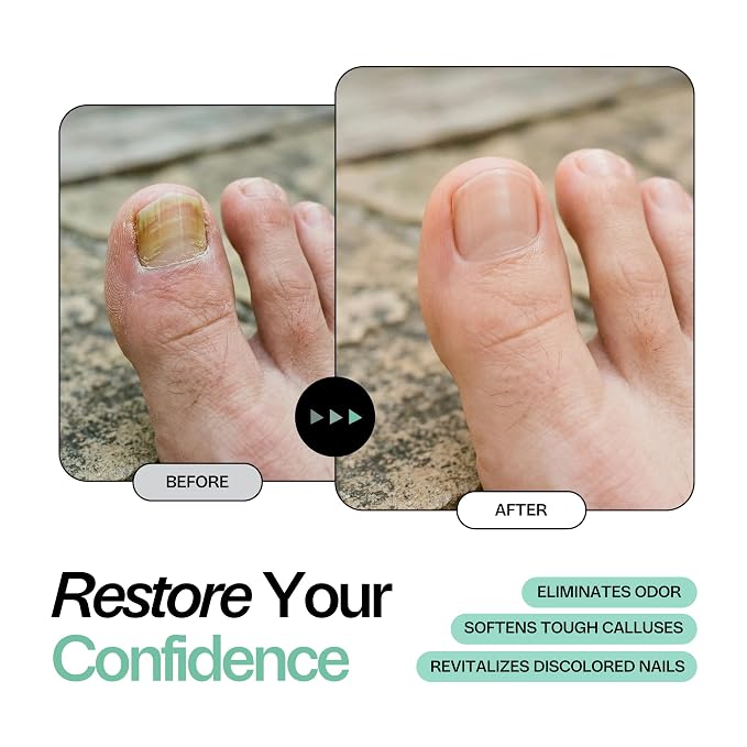 Tea Tree Oil Foot Soak with Epsom Salt - Image 2