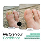 Tea Tree Oil Foot Soak with Epsom Salt - Image 2