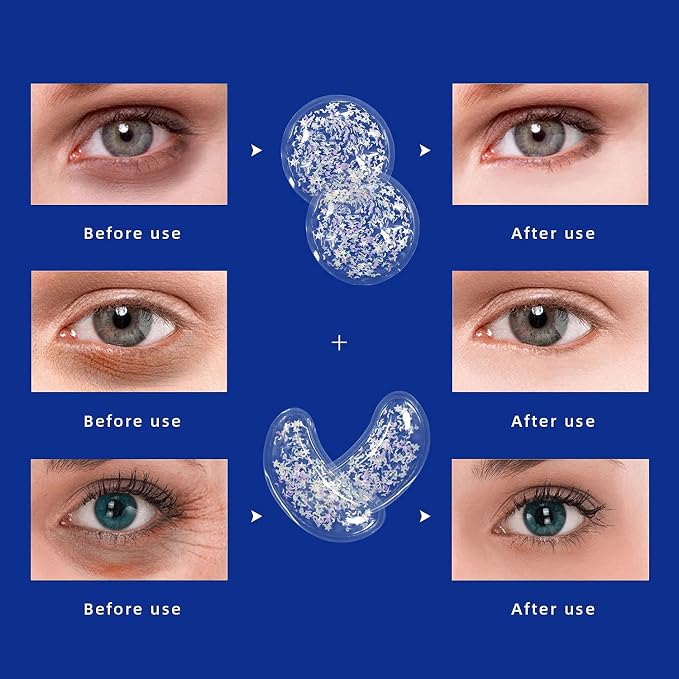 ZNÖCUETÖD Gel Ice Pack Reusable Cooling Eye Pads and Under Eye Patches - Image 6