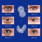 ZNÖCUETÖD Gel Ice Pack Reusable Cooling Eye Pads and Under Eye Patches - Image 6