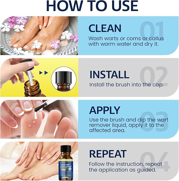 MEOLY Fast-Acting Wart Remover Freeze Off : Salicylic Acid Wart Remover - Image 3