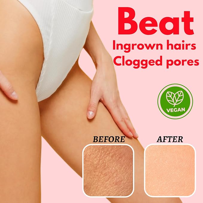 Bikini Area Exfoliator Pack 2-2% Kojic Acid Vitamin C & 7% AHA/BHA Even Skin - Image 4