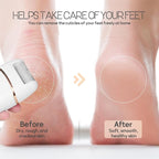 Automatic Callus Remover for Feet, Rechargeable Pedicure Tools for Feet - Image 5