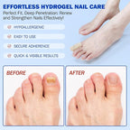 Fungal Nail Patches -Toenail Treatment Extra Strength 21Pcs- Nail Repair - Image 6