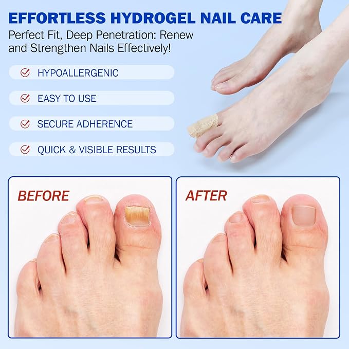 Fungal Nail Patches -Toenail Treatment Extra Strength 21Pcs- Nail Repair - Image 6