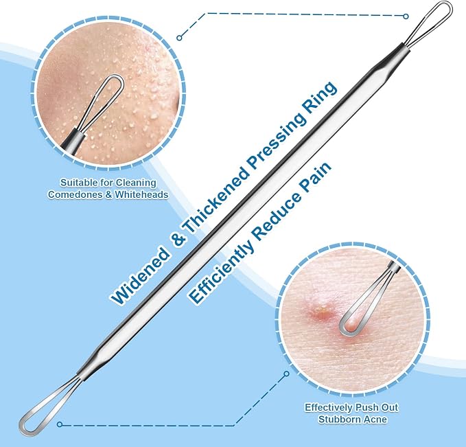Stainless Steel Blackhead Remover, Pimple Extractor, Pimple Popper, Comedone - Image 3