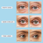 Enaskin Naturals Under Eye Patches - Image 7