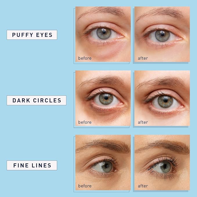 Enaskin Naturals Under Eye Patches - Image 4