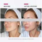 Colorfarm Facial Steamer Nano Ionic: Face Steamer Deep Cleaning Unclogs Pores - Image 6