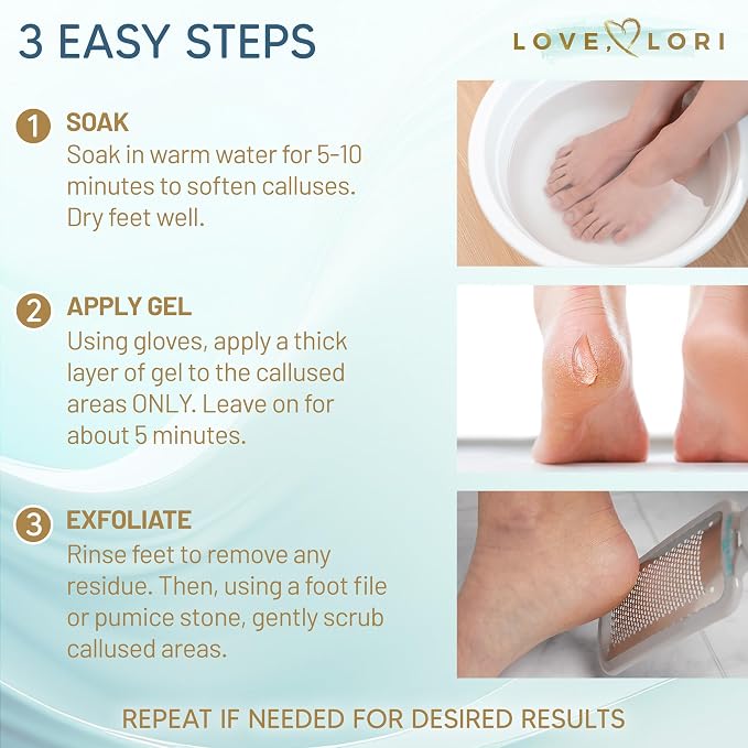 Callus Remover for Feet Foot Callus Remover Gel - Image 4