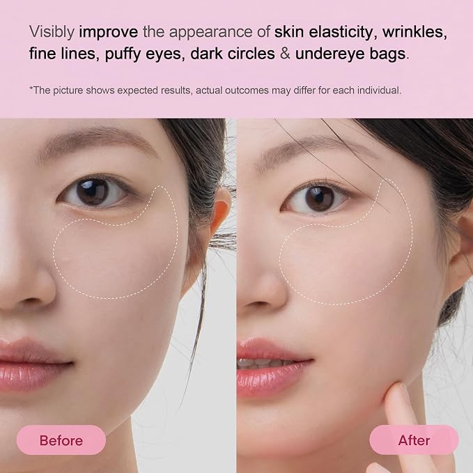 TEREZ & HONOR Collagen Peptide Under Eye Patches - Image 3
