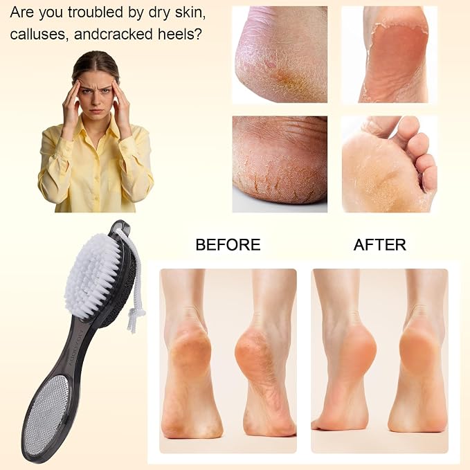 Foot Brush and Pumice Stone for Feet, 4-in-1 Foot File Callus Remover, Feet - Image 3