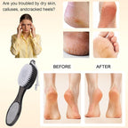 Foot Brush and Pumice Stone for Feet, 4-in-1 Foot File Callus Remover, Feet - Image 3