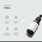 Salicylic Acid 2% Face Serum for Acne, Oil Control & Open Pores | Minimalist - Image 3