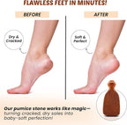 POHS Rectangular Pumice Stone – Callus Remover & Exfoliator - Image 4