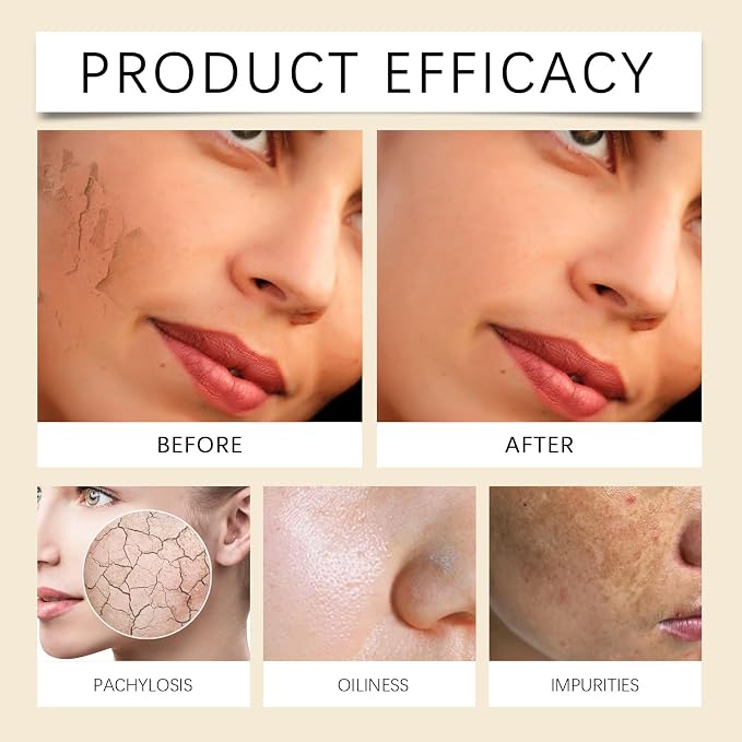 Turmeric Vitamin C Clay Mask, Suitable - Image 4