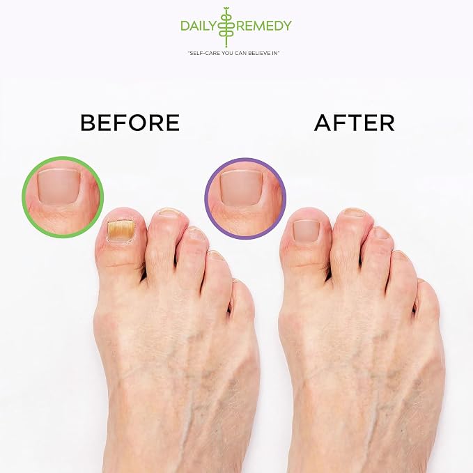 DAILY REMEDY 4-Pack - Image 6