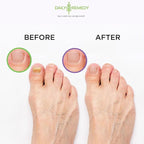 DAILY REMEDY 4-Pack - Image 6