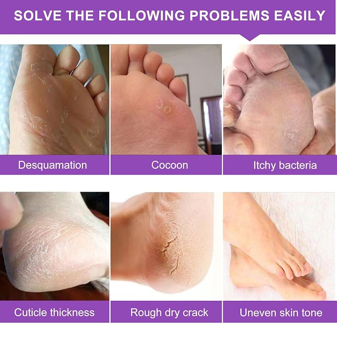 Foot Peeling Mask 5 Pack, Foot Peel Mask Remove Dead Skin, Rough Callus and - Image 4