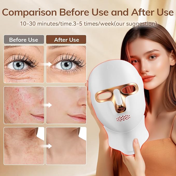 Red Light Therapy Mask for Face, Cordless LED Face Mask Light Therapy, USB C - Image 3