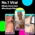 SOME BY MI AHA BHA PHA 30 Days Miracle Acne Clear Body Cleanser 13.5oz – - Image 2
