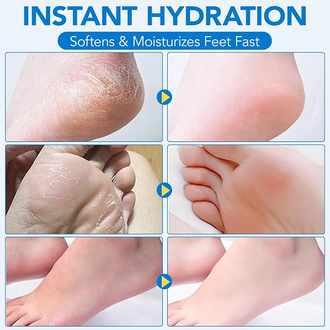 Uruses Urea Cream 60% plus Salicylic Acid 2% Urea Foot Care Stick, Foot Cream - Image 7