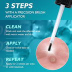 Wart Remover Freeze Off, Wart Corn Removers - Image 7
