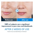 IREV Facial Toner Pads for Exfoliation and Pore Care - Image 2