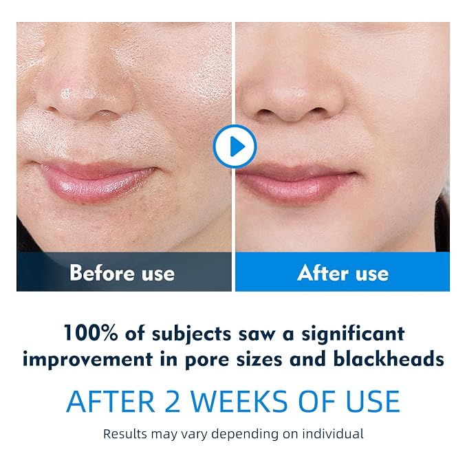 IREV Facial Toner Pads for Exfoliation and Pore Care - Image 2
