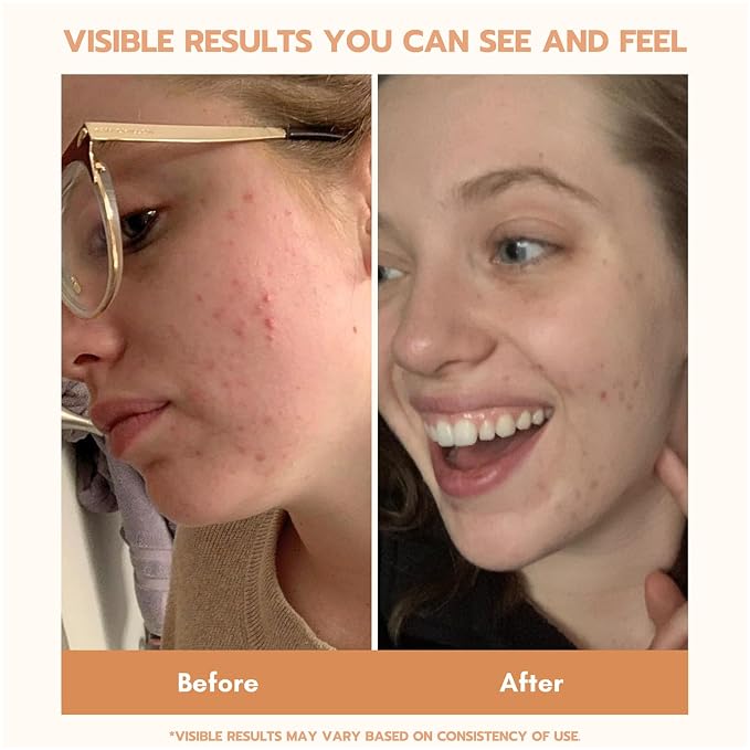 YEOUTH Skin Care Set: Retinol Serum - Image 5