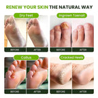 FOOT CURE Tea Tree Oil Foot Soak - Image 4