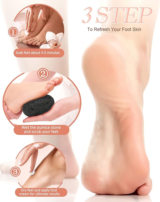 Maryton Natural Pumice Stone for Feet - Image 4