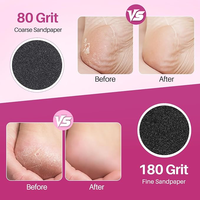 Replaceable Sandpaper for Electric Foot File: 60 Pcs/1 Box Feet Grinder for - Image 4