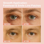 Micro Eye Patches, Under Eye Patches - Image 4