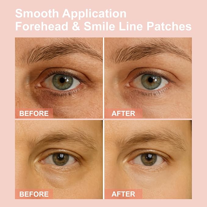 Micro Eye Patches, Under Eye Patches - Image 5