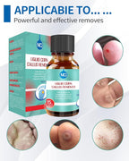 MQ Professional Corn & Callus Remover Liquid - Image 8