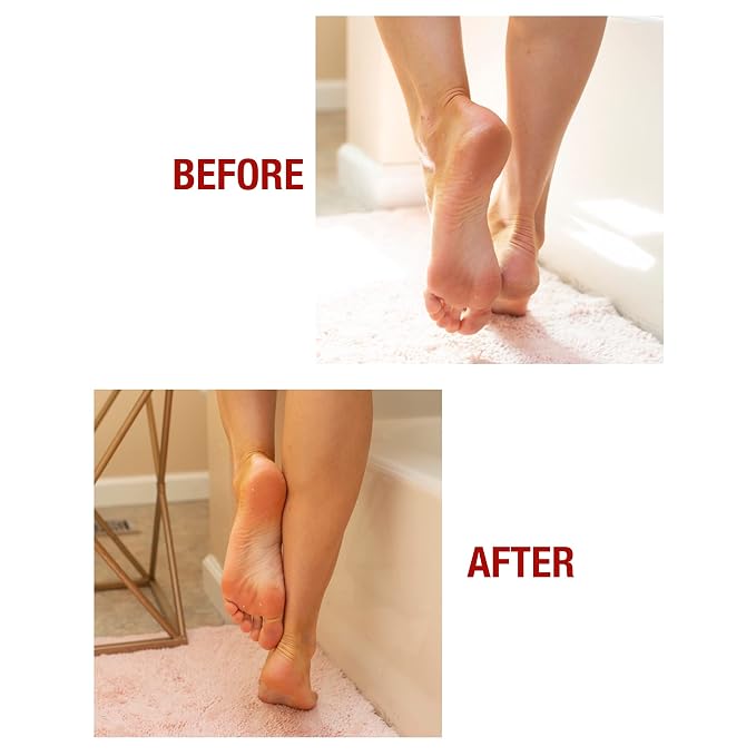 Kerasal Intensive Foot Repair Skin Healing Ointment, 1 Oz and Moisturizing Gel - Image 7