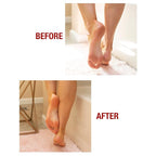 Kerasal Intensive Foot Repair Skin Healing Ointment, 1 Oz and Moisturizing Gel - Image 7