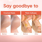 CÉLOR Foot Peeling Mask for Dry Cracked Feet | Foot Mask to Exfoliate Rough - Image 5